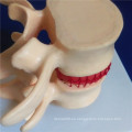 Esqueleto Humano Vertebra Columna Demostración Médica Biología Modelo